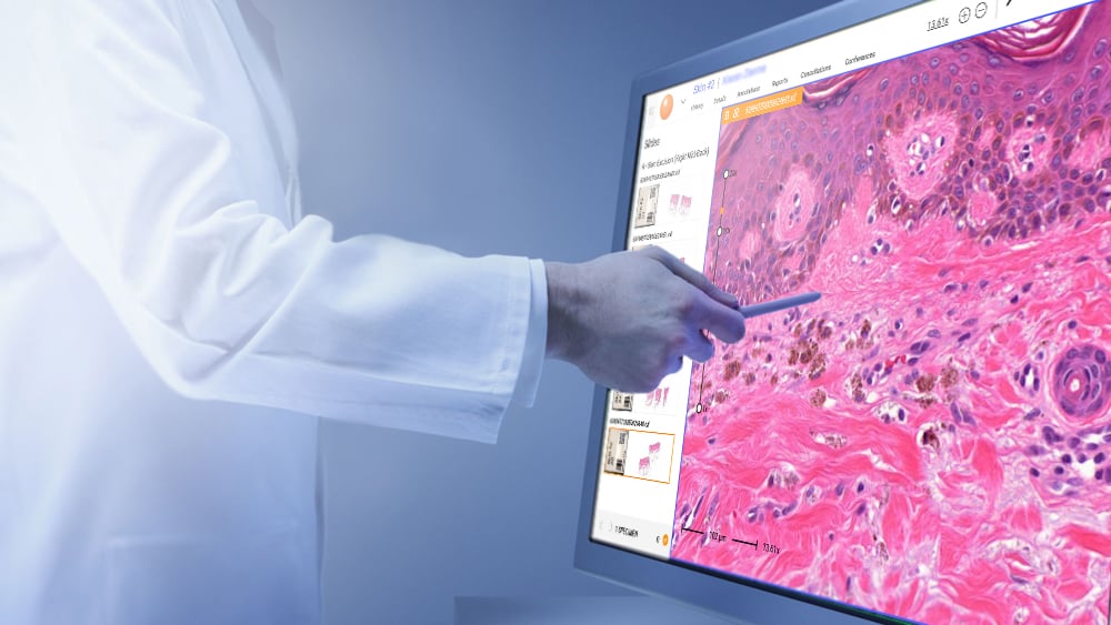 Connecting the Pieces: Why Interoperability Is Defining the Future of Digital Pathology