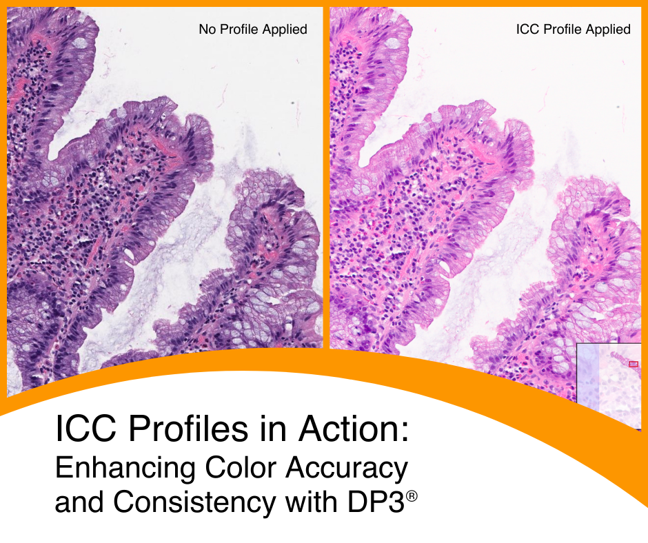 International Color Consortium: Enhancing Color Accuracy and Consistency for Your Digital Pathology Images